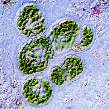 Blue-green algae Cyanobacteria 1