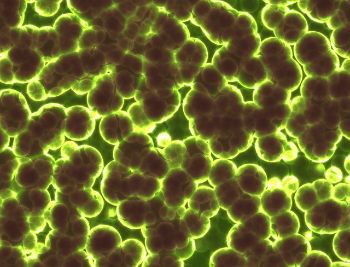 bacteria-MICROBES_1.jpg